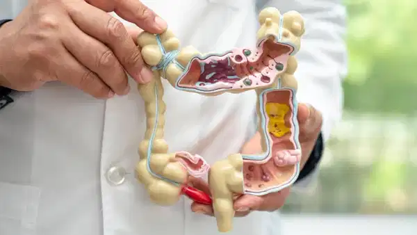 Bağırsak Kanseri Belirtileri ve Dışkı Kontrolü ile Erken Tanı Yöntemleri